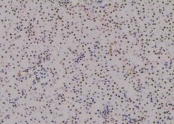 Invitrogen Phospho-Histone H3 (Ser58) Polyclonal Antibody 100 &mu;L | Buy Online | Invitrogen&trade; | Fisher Scientific