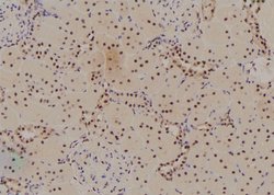 Invitrogen Phospho-Histone H3 (Ser58) Polyclonal Antibody 100 &mu;L | Buy Online | Invitrogen&trade; | Fisher Scientific