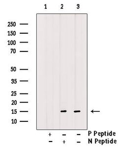 Invitrogen Phospho-Histone H3 (Ser58) Polyclonal Antibody 100 &mu;L | Buy Online | Invitrogen&trade; | Fisher Scientific