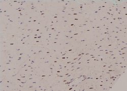 Invitrogen Phospho-Histone H3 (Thr81) Polyclonal Antibody 100 &mu;L; Unconjugated:Antibodies,