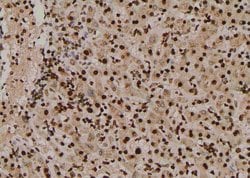 Invitrogen Phospho-Ephrin B1 (Tyr313, Tyr317) Polyclonal Antibody 100 &mu;L | Buy Online | Invitrogen&trade; | Fisher Scientific