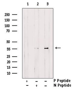 Invitrogen Phospho-Ephrin B1 (Tyr313, Tyr317) Polyclonal Antibody 100 &mu;L | Buy Online | Invitrogen&trade; | Fisher Scientific