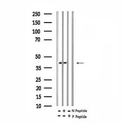 Invitrogen Phospho-Ephrin B1 (Tyr313, Tyr317) Polyclonal Antibody 100 &mu;L | Buy Online | Invitrogen&trade; | Fisher Scientific