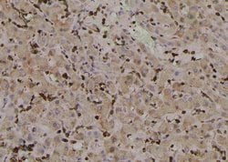 Invitrogen Phospho-PLCB3 (Ser1105) Polyclonal Antibody 100 &mu;L; Unconjugated:Antibodies,