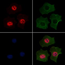 Invitrogen Phospho-MEF2A (Ser479) Polyclonal Antibody 100 &mu;L; Unconjugated:Antibodies,