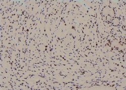 Invitrogen Phospho-MEF2A (Ser479) Polyclonal Antibody 100 &mu;L; Unconjugated:Antibodies,