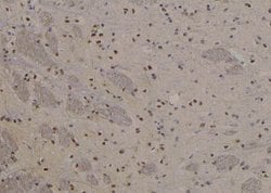 Invitrogen Phospho-MEF2A (Ser479) Polyclonal Antibody 100 &mu;L; Unconjugated:Antibodies,