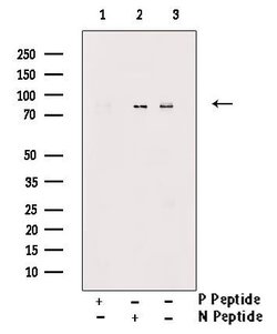 Invitrogen Phospho-PKC epsilon (Thr710) Polyclonal Antibody 100 &mu;L;
