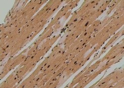 Invitrogen Phospho-TEK (Tyr897) Polyclonal Antibody 100 &mu;L; Unconjugated:Antibodies,