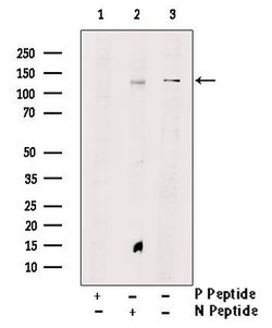 Invitrogen Phospho-TEK (Tyr897) Polyclonal Antibody 100 &mu;L; Unconjugated:Antibodies,