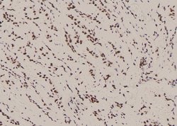 Invitrogen Phospho-SHP2 (Tyr62) Polyclonal Antibody 100 μL; Unconjugated:Antibodies,