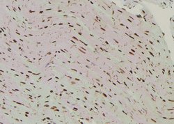 Invitrogen Phospho-SHP2 (Tyr62) Polyclonal Antibody 100 μL; Unconjugated:Antibodies,