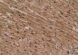 Invitrogen Phospho-Btk (Tyr223, Tyr225) Polyclonal Antibody 100 μL;