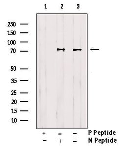 Invitrogen Phospho-Btk (Tyr223, Tyr225) Polyclonal Antibody 100 μL;