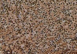 Invitrogen Phospho-FOXM1 (Thr600) Polyclonal Antibody 100 &mu;L; Unconjugated:Antibodies,