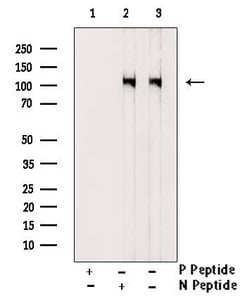 Invitrogen Phospho-DDR1 (Tyr520) Polyclonal Antibody 100 &mu;L; Unconjugated:Antibodies,