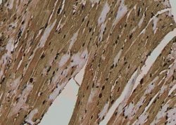 Invitrogen Phospho-NMDAR2A (Tyr943) Polyclonal Antibody 100 &mu;L; Unconjugated:Antibodies,