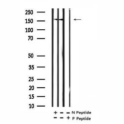 Invitrogen Phospho-NMDAR2A (Tyr943) Polyclonal Antibody 100 &mu;L; Unconjugated:Antibodies,