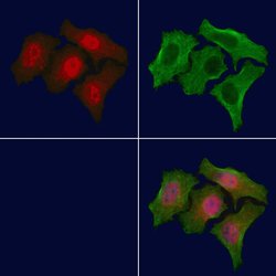 Phospho-Acetyl-CoA Carboxylase (Thr1196) Polyclonal Antibody, Invitrogen