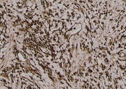 Phospho-Acetyl-CoA Carboxylase (Thr1196) Polyclonal Antibody, Invitrogen