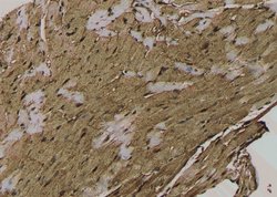 Phospho-Acetyl-CoA Carboxylase (Thr1196) Polyclonal Antibody, Invitrogen