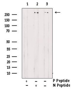 Phospho-Acetyl-CoA Carboxylase (Thr1196) Polyclonal Antibody, Invitrogen