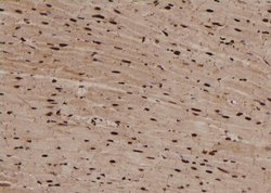 Invitrogen Phospho-TDP-43 (Ser409) Polyclonal Antibody 100 &mu;L; Unconjugated:Antibodies,