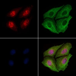 Invitrogen Phospho-TDP-43 (Ser409) Polyclonal Antibody 100 &mu;L; Unconjugated:Antibodies,
