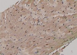 Invitrogen Phospho-MST2 (Ser316) Polyclonal Antibody 100 &mu;L; Unconjugated:Antibodies,