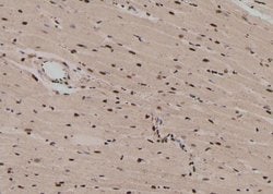 Invitrogen Phospho-MST2 (Ser316) Polyclonal Antibody 100 &mu;L; Unconjugated:Antibodies,