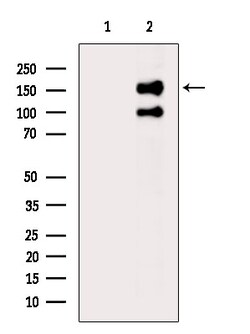 Phospho-NMDAR2B (Ser1303) Polyclonal Antibody 100 &mu;L | Buy Online | Thermo Scientific | Fisher Scientific
