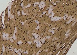 Invitrogen Phospho-CaMKII alpha/beta/delta (Ser235) Polyclonal Antibody