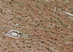 Invitrogen Phospho-CaMKII alpha/beta/delta (Ser235) Polyclonal Antibody