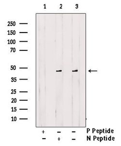 Invitrogen Phospho-CaMKII alpha/beta/delta (Ser235) Polyclonal Antibody