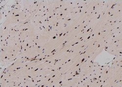 Invitrogen Phospho-RUNX2 (Ser28) Polyclonal Antibody 100 &mu;L; Unconjugated:Antibodies,