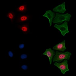 Invitrogen Phospho-RUNX2 (Ser28) Polyclonal Antibody 100 &mu;L; Unconjugated:Antibodies,