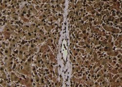 Invitrogen Phospho-CaMKI (Thr177) Polyclonal Antibody 100 &mu;L; Unconjugated:Antibodies,
