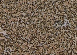 Invitrogen Phospho-CaMKI (Thr177) Polyclonal Antibody 100 &mu;L; Unconjugated:Antibodies,