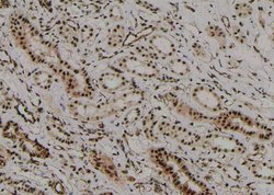 Invitrogen Phospho-Beclin 1 (Ser90, Ser93, Ser96) Polyclonal Antibody 100