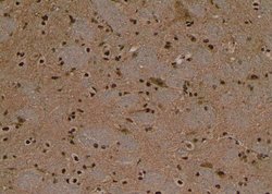 Invitrogen Phospho-Beclin 1 (Ser90, Ser93, Ser96) Polyclonal Antibody 100