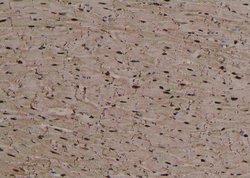 Invitrogen Phospho-Beclin 1 (Ser90, Ser93, Ser96) Polyclonal Antibody 100