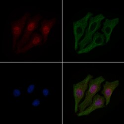 Invitrogen Phospho-IRF3 (Ser14) Polyclonal Antibody 100 μL; Unconjugated:Antibodies,