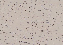Invitrogen Phospho-NFATC4 (Ser289) Polyclonal Antibody 100 &mu;L; Unconjugated:Antibodies,