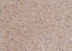 Invitrogen Phospho-NuMA (Ser1225) Polyclonal Antibody 100 &mu;L | Buy Online | Invitrogen&trade; | Fisher Scientific