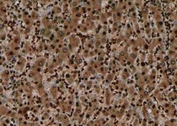 Invitrogen Phospho-EphA7 (Tyr614) Polyclonal Antibody 100 &mu;L; Unconjugated:Antibodies,