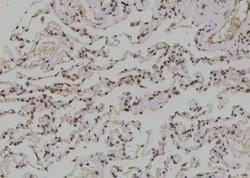 Invitrogen Phospho-C/EBP epsilon (Ser181) Polyclonal Antibody 100 &mu;L;