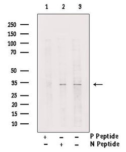 Invitrogen Phospho-C/EBP epsilon (Ser181) Polyclonal Antibody 100 &mu;L;
