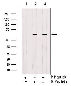 Invitrogen Phospho-GRK1 (Ser21) Polyclonal Antibody 100 &mu;L; Unconjugated:Antibodies,