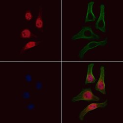 Phospho-EZH2 (Thr487) Polyclonal Antibody:Antibodies, Polyclonal