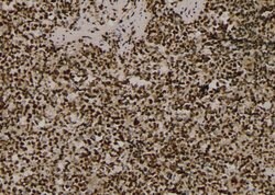 Phospho-EZH2 (Thr487) Polyclonal Antibody:Antibodies, Polyclonal